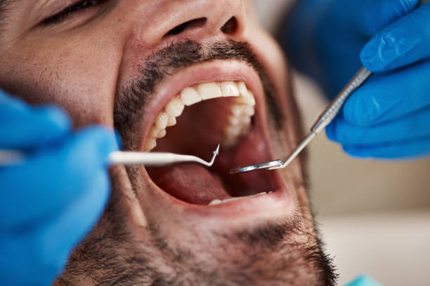 Best Emergency Dental Services for Seniors in South Blooming Grove, NY